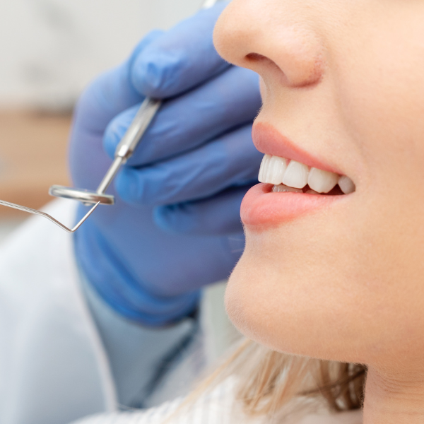 歯科医師の治療のイメージ画像